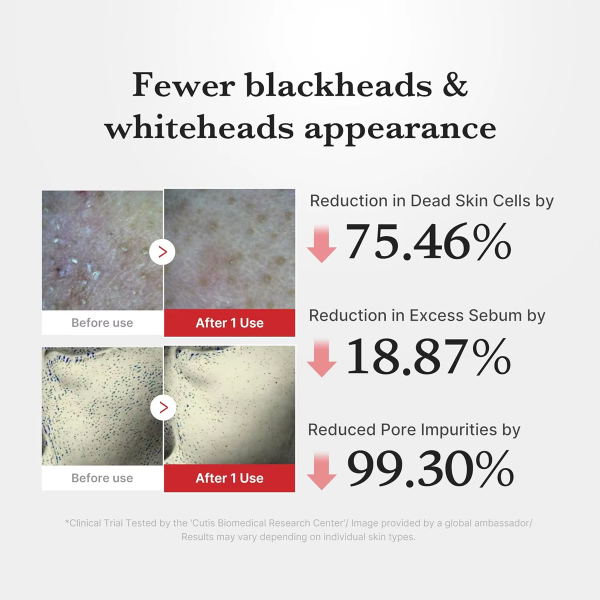 Hypochlorous Acid Rice Peel Shot Exfoliating Serum for Dead Skin Cells Pore Care,Blackheads &Excess Sebum Control Smoothing Care